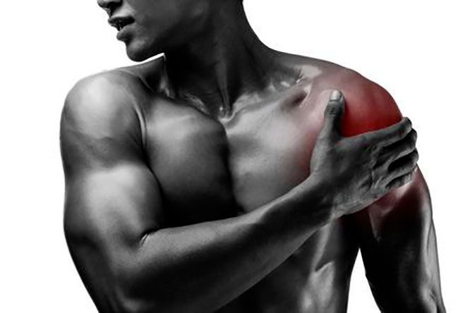 Артроз плечевого сустава