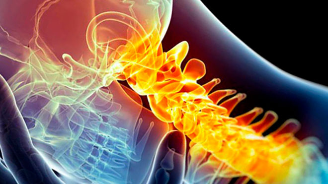 больная шея и плечо