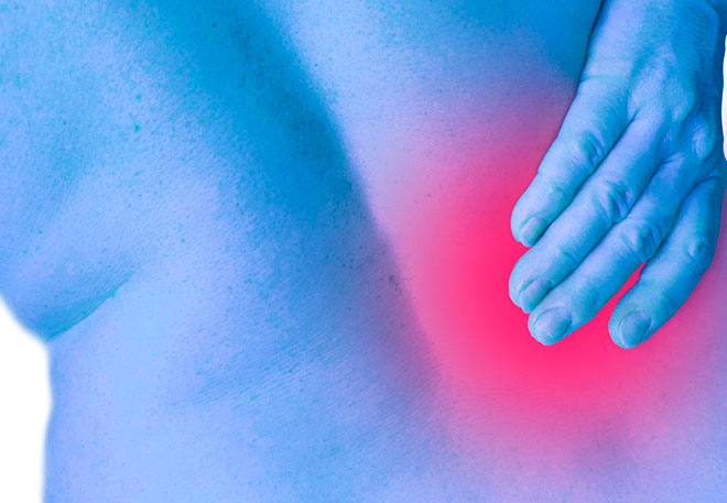 остеохондроз поясницы