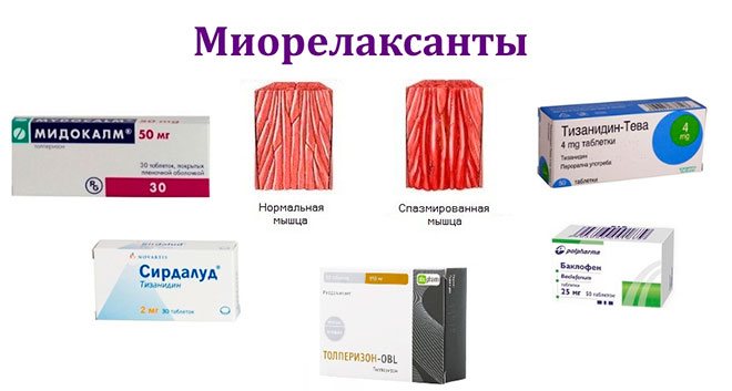 набор миорелаксантов для лечения остеохондроза шейного и грудного отдела