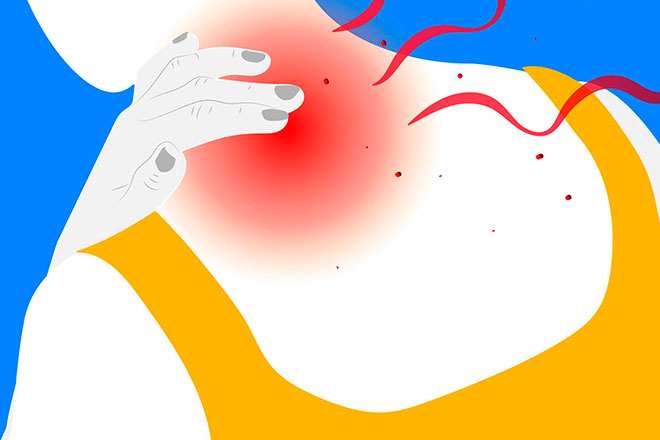 рисунок шейной боли