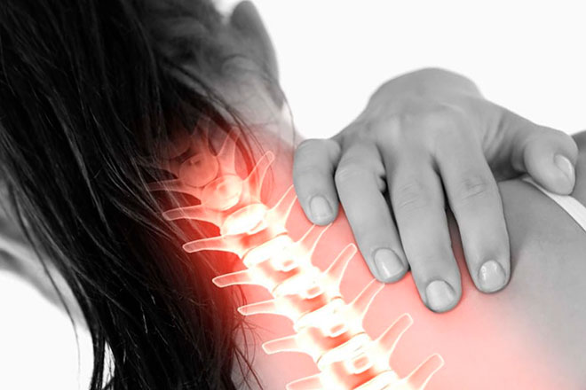 у девушки синдром позвоночной артерии