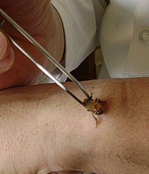 apiterapia apiterapia