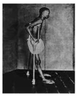 beri_beri2 beri_beri2