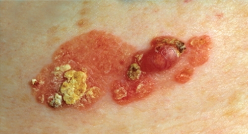 ??????????????????? ???????????????????