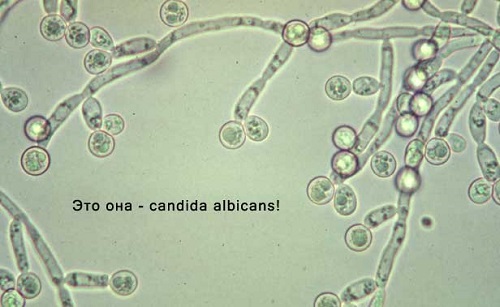 candida1
