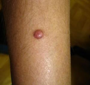 ??????????????????????????????? ???????????????????????????????