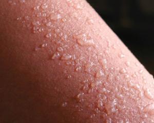 dermatoskl dermatoskl