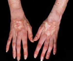 dermatoskl2 dermatoskl2