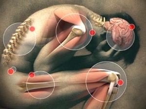 fibromialgija2 fibromialgija2