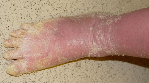 ??????????????????????????????? ???????????????????????????????