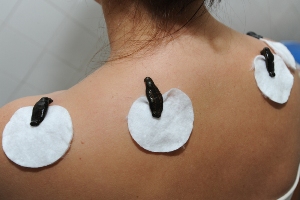 girudoter2 girudoter2