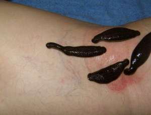 girudoter3 girudoter3