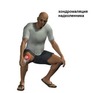 hondromal2 hondromal2