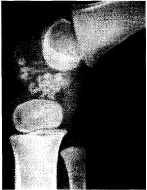 hondromat2 hondromat2