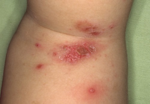 ???????????????????????????????????? ????????????????????????????????????