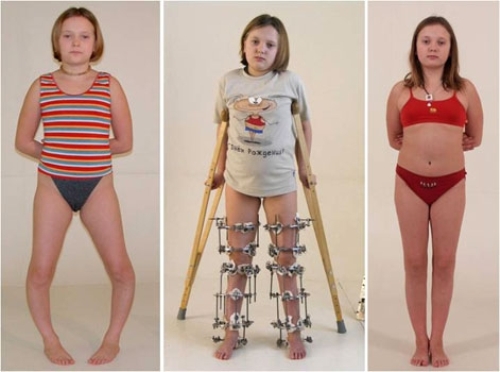 ispravlen-oper ispravlen-oper