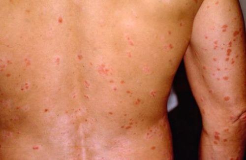 kap-parap2 kap-parap2