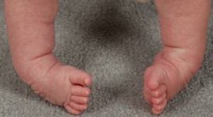 kosolapost2 kosolapost2