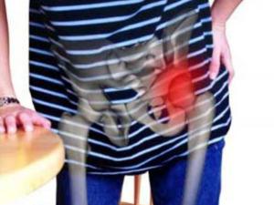 koxartroz-2 koxartroz-2