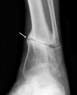 lozhn-sust lozhn-sust