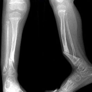 lozhn-sust2 lozhn-sust2