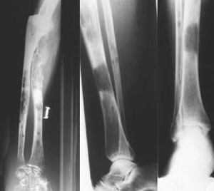 miel-kost2 miel-kost2