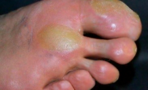 natoptish2 natoptish2