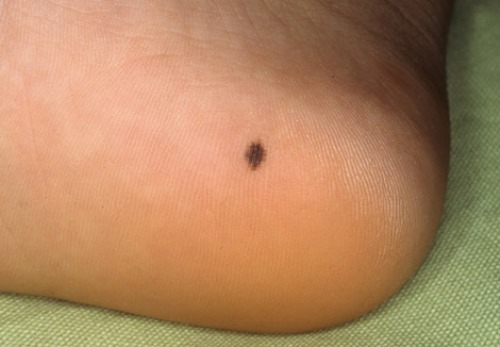 ???????????????????????????????????? ????????????????????????????????????