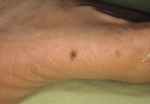 ???????????????????????????????????? ????????????????????????????????????