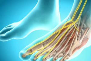 nevr-maloberc2 nevr-maloberc2