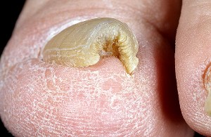 onihogrif2 onihogrif2