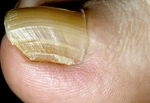 onihogrif3 onihogrif3