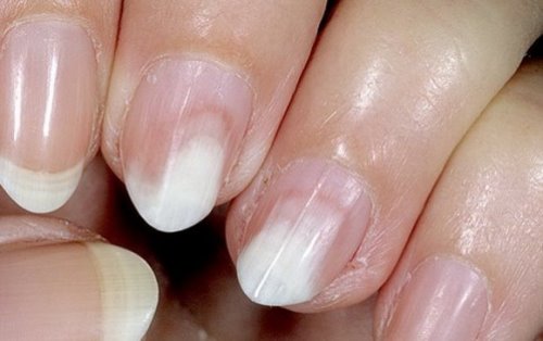 oniholizis oniholizis