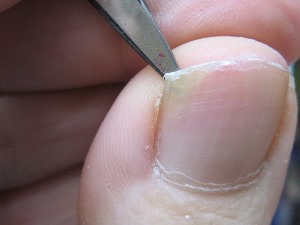 oniholizis2 oniholizis2