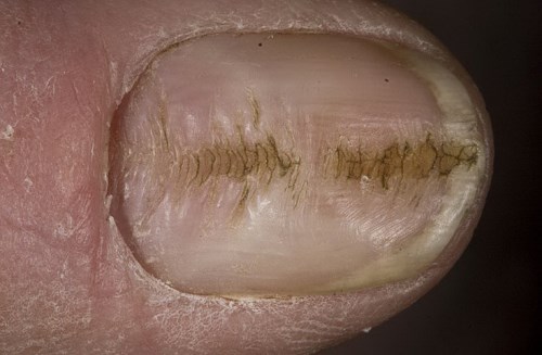 onihotill2 onihotill2