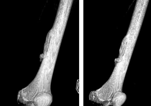 ost-osteom3 ost-osteom3