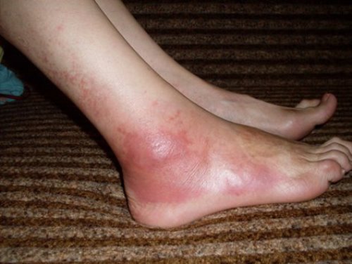 ???????????????????????????? ????????????????????????????