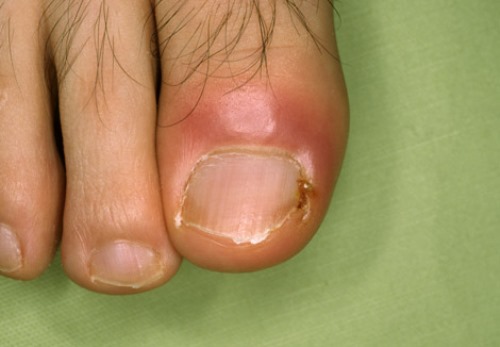 ???????????????????????????????????? ????????????????????????????????????