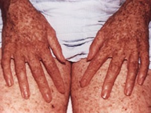 pigm-kser2 pigm-kser2