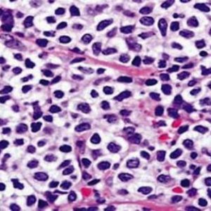 plazmocit2 plazmocit2