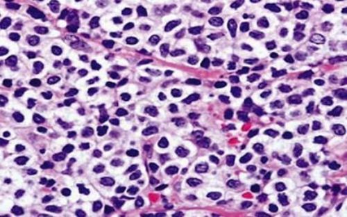 plazmocit2 plazmocit2