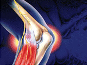 polimialg2 polimialg2