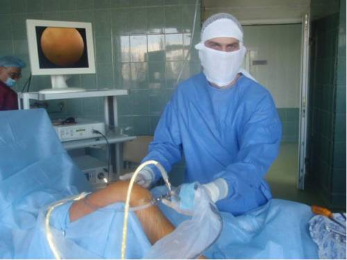 posle-artroskop2 posle-artroskop2