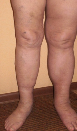 OLYMPUS DIGITAL CAMERA OLYMPUS DIGITAL CAMERA