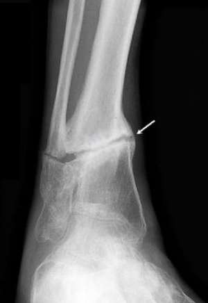 psevdoart2 psevdoart2