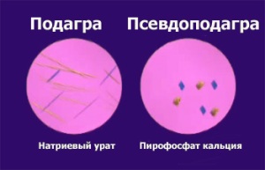 psevdopodag psevdopodag