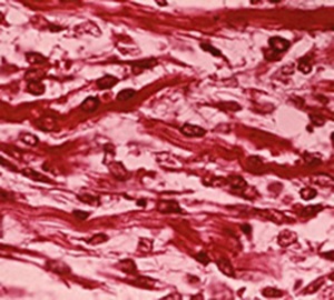 rabdomios2 rabdomios2