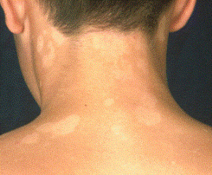 razn-lish2 razn-lish2