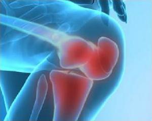 revmatizm2 revmatizm2